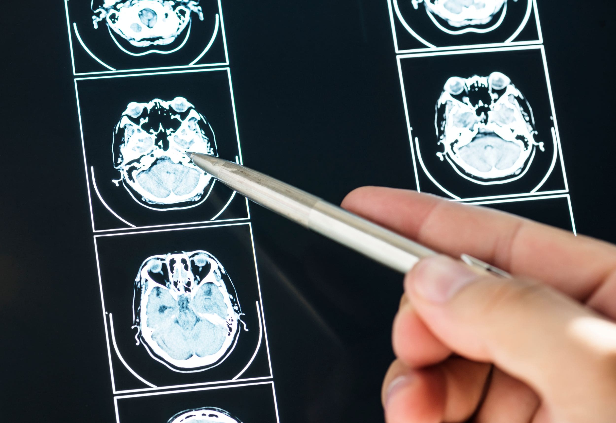 doctor-en-neurocirugia.jpg