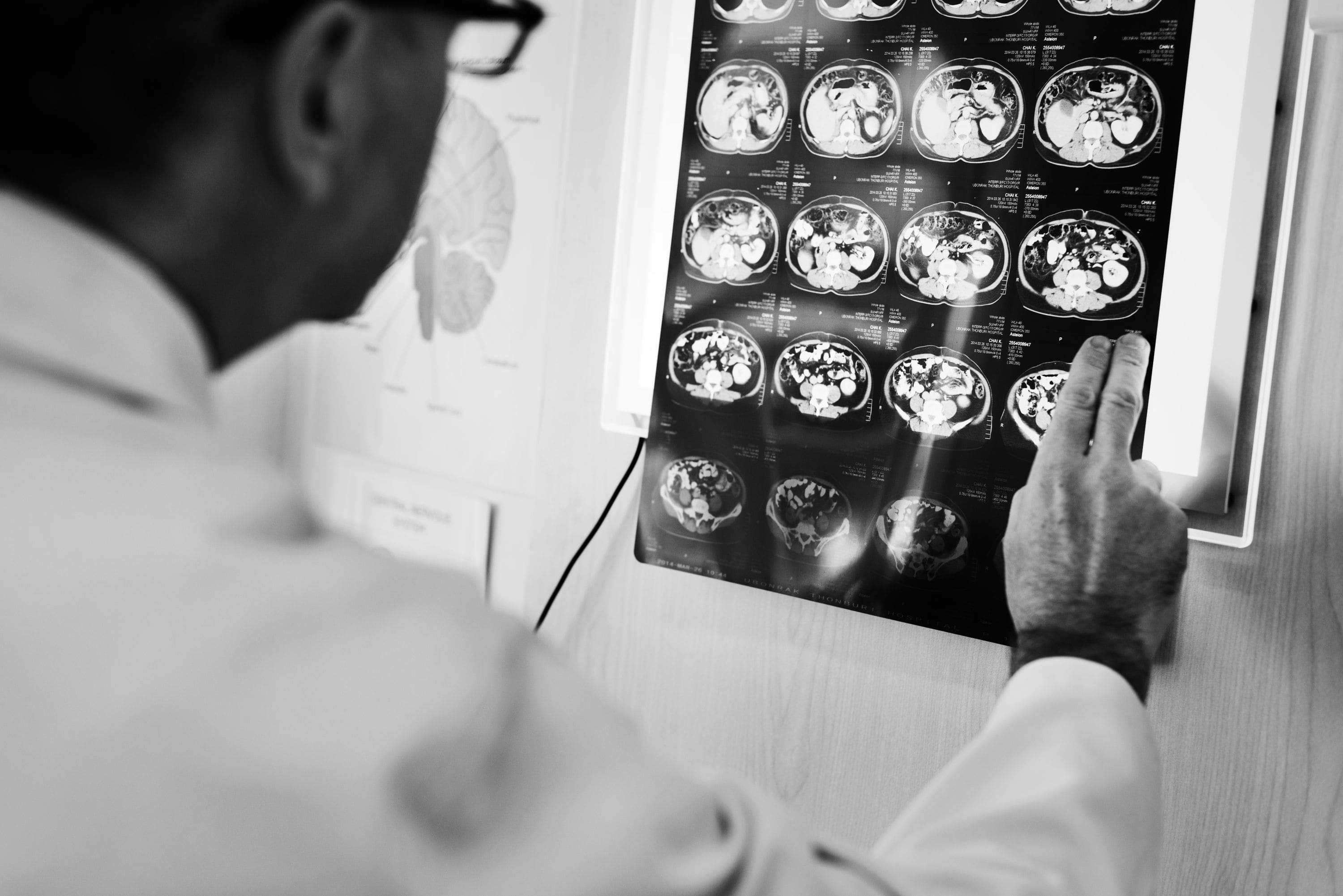 servicio-de-neurociruga-en-cdmx.jpg